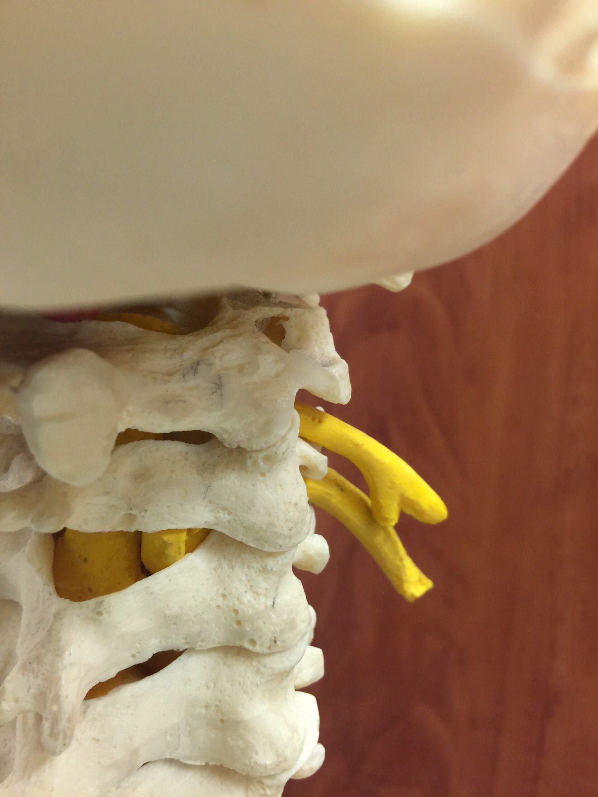 ACDF (Neck Surgery from the Front)