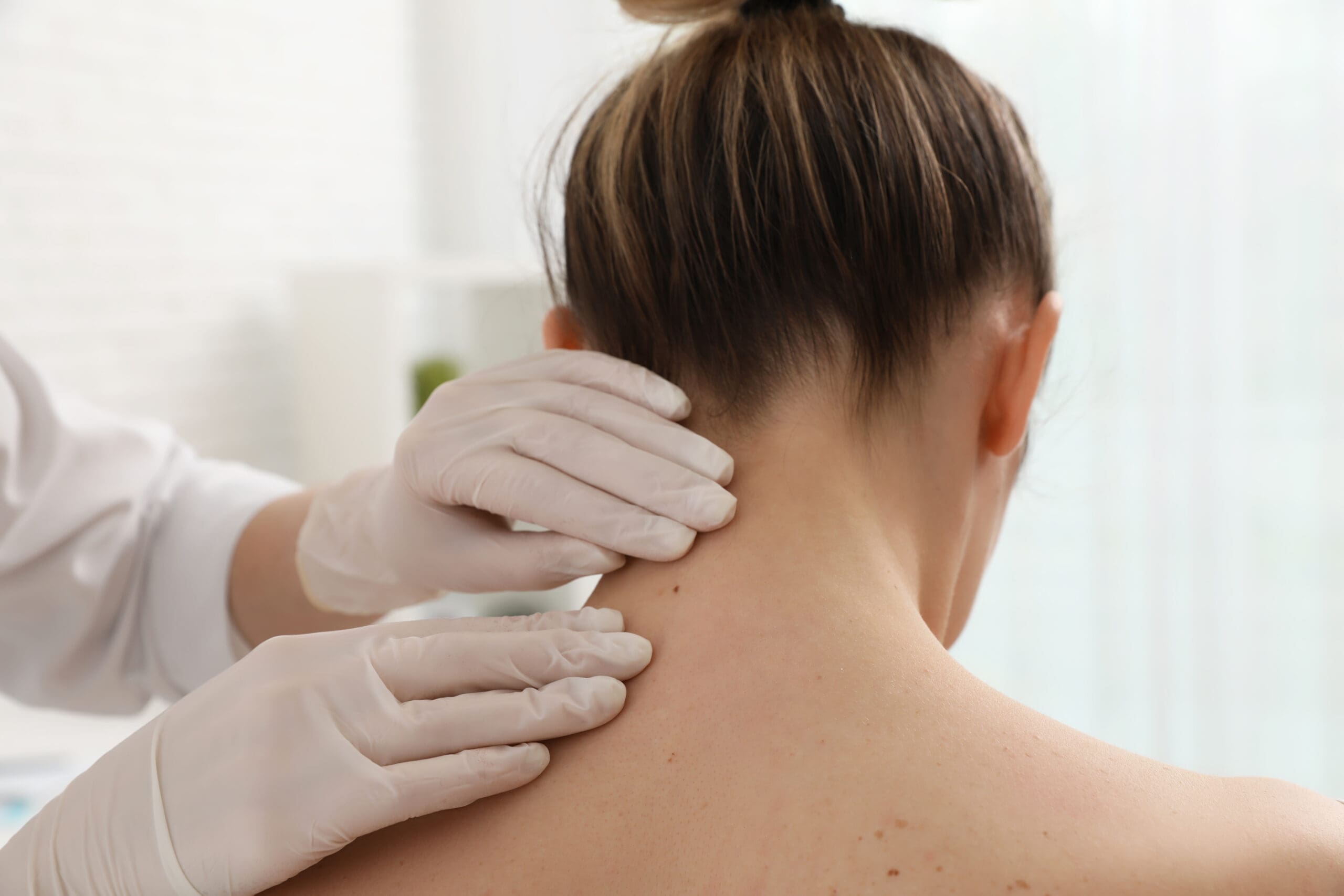 Dermatologist examining patient's birthmark in clinic, closeup